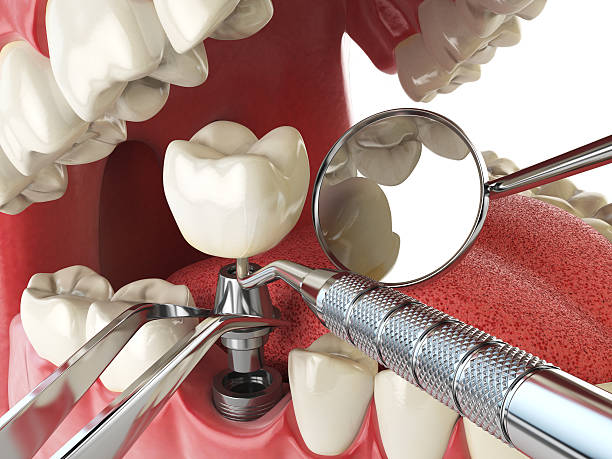 Best Walk-In Emergency Dental Services in Embreeville, TN